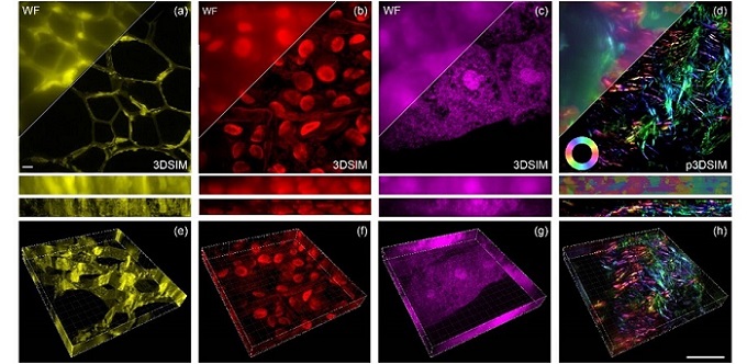 Open-source core technology embedded inside projector hardware enables high-speed, auto-polarization-modulated, 3D structured illumination microscopy (SIM) imaging. The image shows 3DSIM reconstruction of plant and animal tissue samples: (a): Cell walls in oleander leaves, (b): hollow structures within black algal leaves, (c): root tips of corn tassels, and (d): actin filaments in mouse kidney tissue. The corresponding maximum intensity projection (MIP) images are shown respectively in the bottom row (e-h). Scale bar: 2 µm. Courtesy of Li, Cao, et al., doi 10.1117/1.APN.3.1.016001.