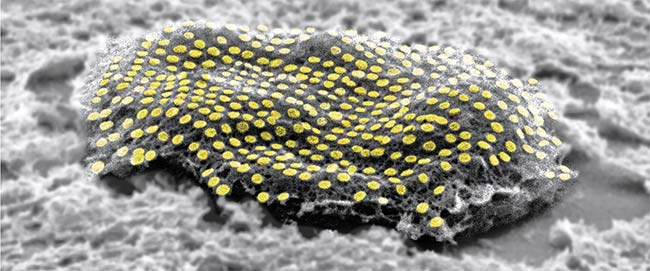 An array of nanodots on a human skin fibroblast cell. Courtesy of Kam Sang Kwok and Soo Jin Choi/Gracias Lab at Johns Hopkins University.