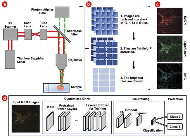 Figure 4. Samples are imaged in a multiphoton microscope (a). Images are then flat-field corrected, and the brightest layer is chosen for analysis (b). This is repeated for three imaging channels: nicotinamide adenine dinucleotide and hydrogen (NADH), lipofuscin, and second harmonic generation (SHG). Images are shown brightened and with tiles stitched together for ease of viewing (c). A schematic of customized convolutional neural networks (CNNs) with fine-tuning (d). FC: fully connected layer. Courtesy of University of Arizona.