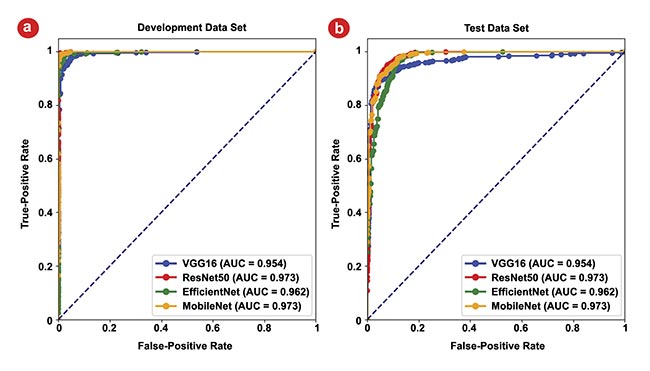 Figure 6. The area under the curve (AUC) for receiver operating characteristic (ROC) curves of the four models. The ROC curves for the development data set, where the highest AUC values for all four models approach 1 (a). The ROC curves for the test data set, all >0.95, highlighting the models’ strong generalization capabilities (b). Courtesy of University of Arizona.