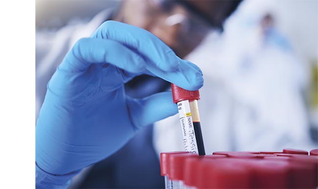 Raman spectroscopy could soon aid traditional blood diagnostics at the patient’s bedside. Courtesy of iStock.com/Jacob Wackerhausen.
