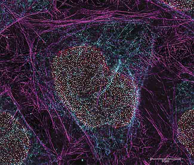 A multicolor image acquired using TauSTED Xtend, which includes Vimentin AF 594 (cyan), Phalloidin ATTO 647N (magenta), and NUP107 CF680R (glow). Triple color stimulation emission depletion (STED) imaging with a single depletion line at low STED power. Scale bar: 5 µm. Sample courtesy of Ludwig Maximilian University. Courtesy of Leica Microsystems.