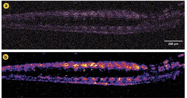 Figure 4. Second-harmonic generation (SHG) imaging of zebrafish muscle before and after denoising. A noisy SHG image with obscured structural details (a). A denoised image using Noise2Void (N2V 2D), revealing more explicit muscle fiber patterns and reducing noise (b). Adapted with permission from Reference 2.
