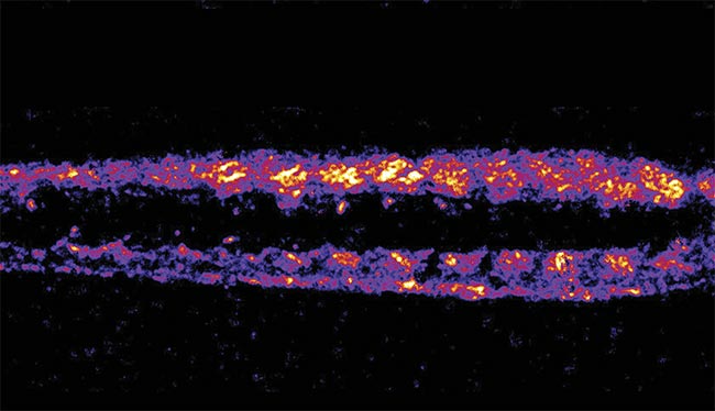 A denoised second-harmonic generation (SHG) image of zebrafish muscle using machine learning, revealing explicit fiber patterns with reduced noise. Adapted with permission from Reference 2.