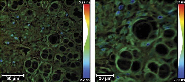 A FLIM image of a mouse colon. Courtesy of HORIBA.