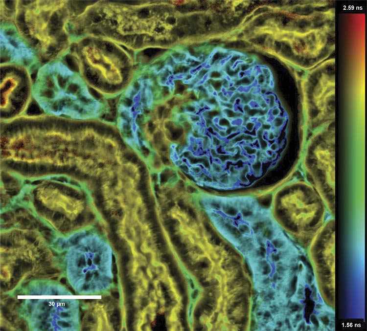 A fluorescence lifetime imaging microscopy (FLIM) image of a mouse brain. Courtesy of HORIBA.