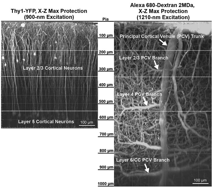Deep two-photon (2P) imaging of an aged Thy1-YFP mouse showing fluorescently labeled neurons (900-nm excitation) (left) and Alexa Fluor 680-labeled vasculature (1210-nm excitation) (right). Impaired capillary-venous drainage contributes to gliosis and demyelination in mouse white matter during aging. Adapted with permission from Reference 1.