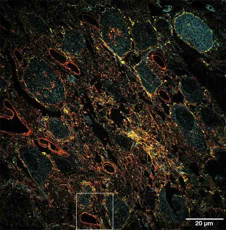 Two-dimensional structured illumination microscopy images of a mouse brain slice with a wide field of view. The spatial resolution is ~130 nm. Courtesy of Excelitas.