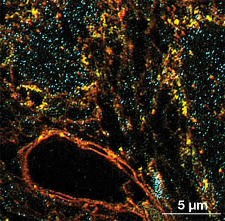 Two-dimensional structured illumination microscopy images of a mouse brain slice with a wide field of view. The spatial resolution is ~130 nm. Courtesy of Excelitas.
