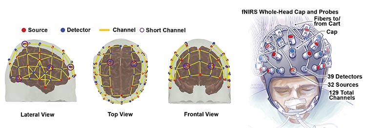 Bringing fNIRS capability into new frontiers is professor Adrian Owen’s work in neuroimaging and the study of patients in a vegetative state. Images courtesy of Adrian Owen/University of Western Ontario. Artwork by Cassio Lynm.