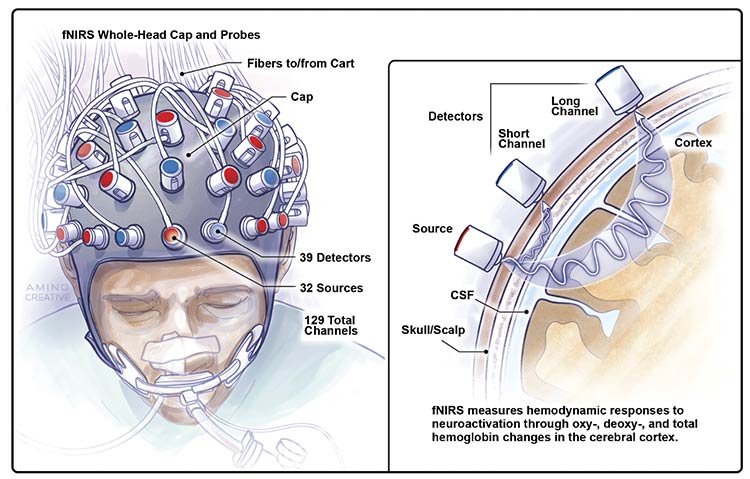 Bringing fNIRS capability into new frontiers is professor Adrian Owen’s work in neuroimaging and the study of patients in a vegetative state. Images courtesy of Adrian Owen/University of Western Ontario. Artwork by Cassio Lynm.