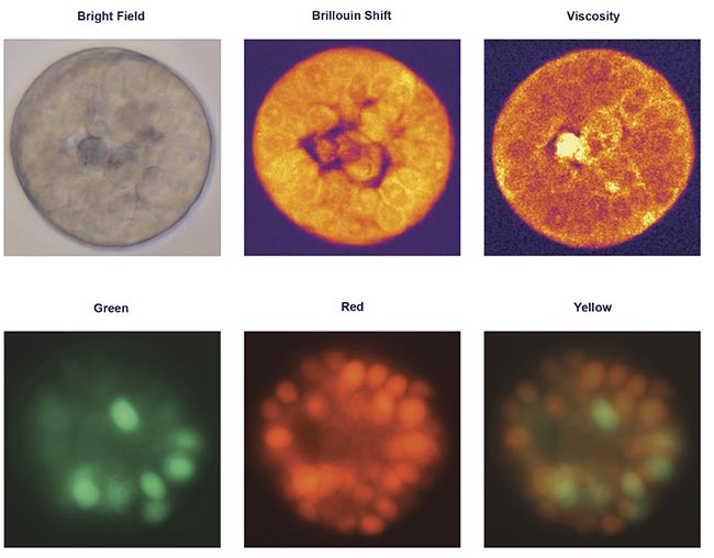 Brillouin measurements can provide clear illustrations of elasticity and viscosity, which are otherwise inaccessible, in addition to and in correlation with other optical contrast methods. Courtesy of CellSense Technologies.