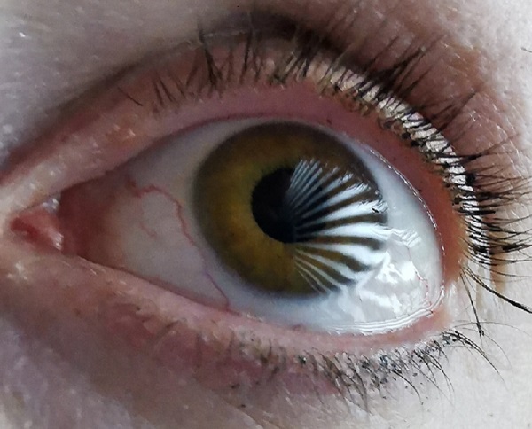 A pattern of distorted lines is visible as a reflection in this close-up view of a human eye. By observing the deformation of illumination patterns reflected off the eye's surface, researchers in Willomitzer's group can capture gaze direction information from tens of thousands of surface points instead of the dozen or so used by conventional eye-tracking methods. Courtesy of the University of Arizona/Florian Willomitzer