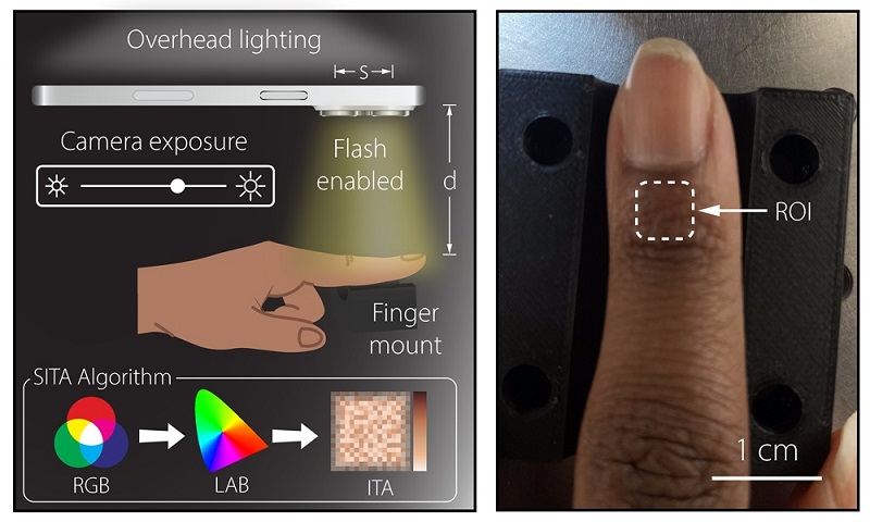 Accurate Skin Tone Measurement with Smartphone Improves Pulse Oximetry
