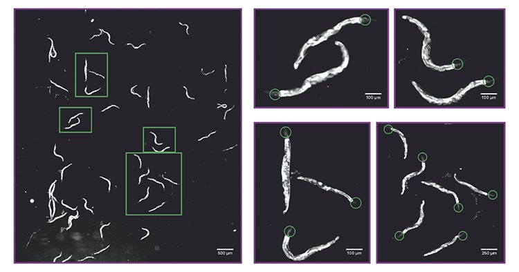 Calcium imaging of a population of Caenorhabditis elegans expressing a calcium indicator in amphid wing “C” (AWC) chemosensory neurons. The system allows the recording of the activity of multiple nematodes (roundworms) at once (50 in the left image), enabling identification of tiny details such as somas and neurites of neurons with calcium indicator expression (panels on the right, green circles). Courtesy of D-Tails srl SB.