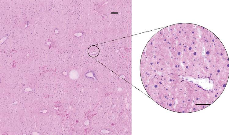 Figure 1. A label-free virtual hematoxylin and eosin-stained liver section. Courtesy of Refined Laser Systems.