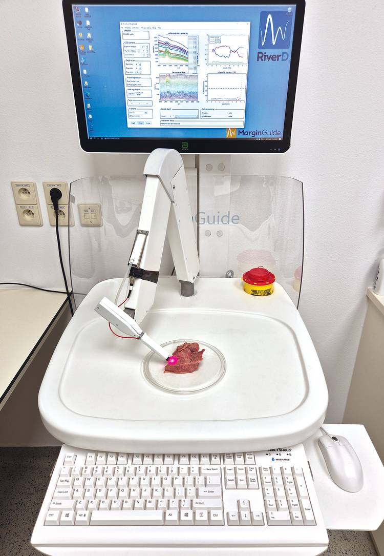 Figure 3. RiverD’s Raman system, which has found application in assessing soft tissue resection margins. Courtesy of RiverD International.