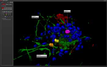 Melodrama Leerling Aanbeveling Microscopy Software | Leica Microsystems GmbH | Jun 2014 | BioPhotonics Melodrama Leerling Aanbeveling Microscopy Software | Leica Microsystems GmbH | Jun 2014 | BioPhotonics