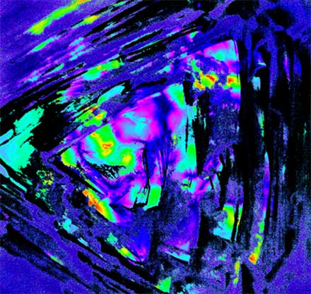 Birefringence Microscopic Imager