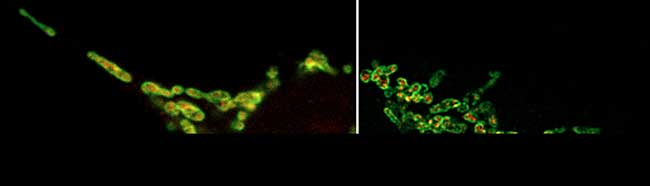 Laser Scanning Microscopes