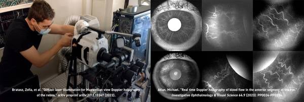 Vision Research - Ultrafast Optical Coherence Tomography (OCT) with Phantom High-Speed Camera