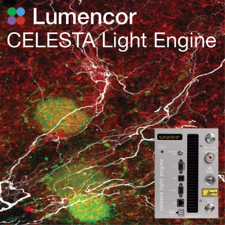 Lumencor Inc. - CELESTA Light Engine