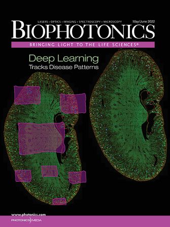 BioPhotonics: May/Jun 2022