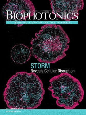 BioPhotonics: Nov/Dec 2022