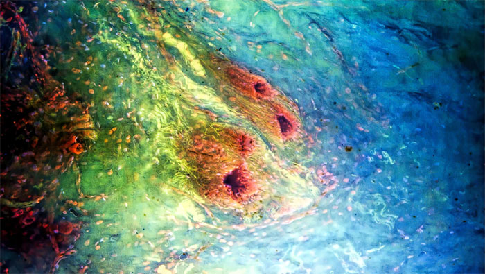 MUSE Microscope_breast ducts_R Levenson, MD.