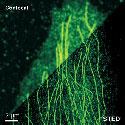 STED Microscopy Made Easy