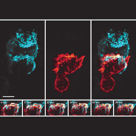 An Oblique Plane Light-Sheet Microscope with 200-nm-Scale Resolution