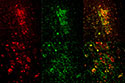 Optogenetics Used to Induce REM Sleep in Mice