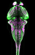 Fluorescent Label Aids Whole-Brain Imaging In Vivo