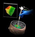Study: OCT Could Aid Brain Tumor Removal